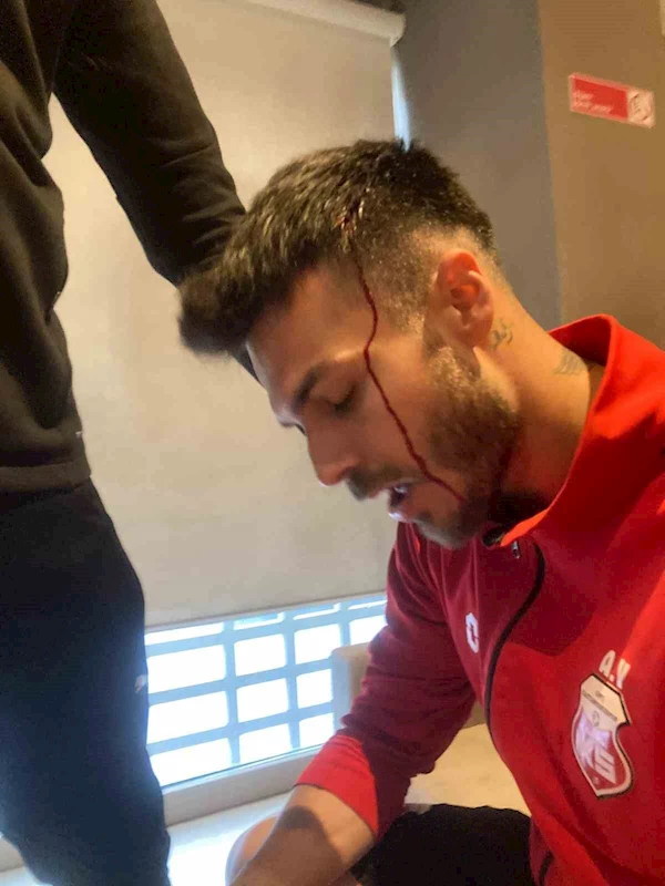 Iğdır’da taraftarlar Kastamonuspor otobüsünü taşladı
